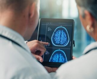 Fibrillazione atriale e declino cognitivo