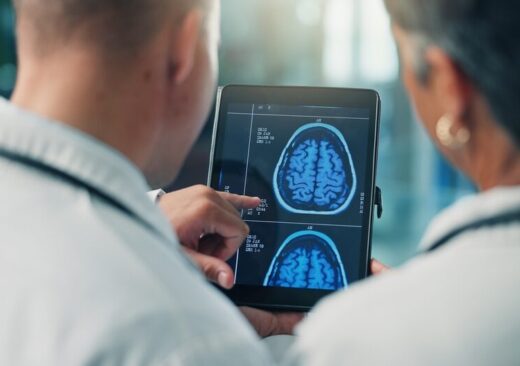 Fibrillazione atriale e declino cognitivo