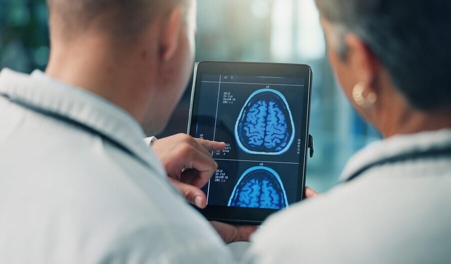 Fibrillazione atriale e declino cognitivo